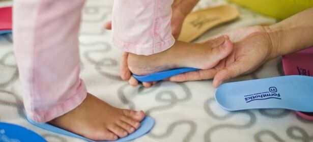 Einlegesohlen mit Valgus -Verformung des Fußes bei Kindern